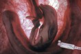 /album/resim-galerisi/a1102588-fc5a-47a1-ad62-47995ca78586-jpg/